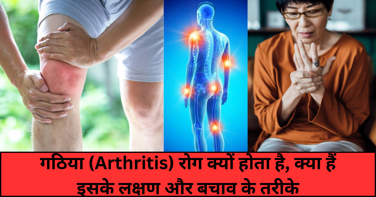 Arthritis meaning in Hindi, गठिया रोग क्यों होता है, क्‍या हैं इसके लक्षण और बचाव के तरीके 2023